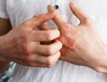 Причины появления красных мелких точек на коже тела