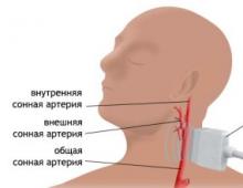 Efektivní duplexní skenování hlavy a krku: vše, co potřebujete vědět