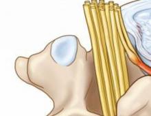 How to cure cervical osteochondrosis with tablets?