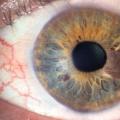 B-scan oka Ultrazvuk orgánu zraku: indikace, kontraindikace